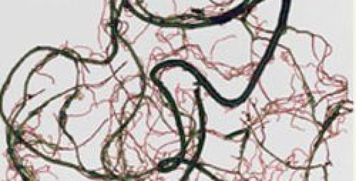 SISTEMAS DE ANÁLISIS DE IMAGEN DE REGENT INSTRUMENTS